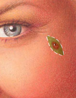 skin cancer 4 skin cancer 4