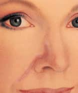 skin cancer 7 skin cancer 7