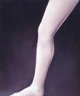 spider veins 4