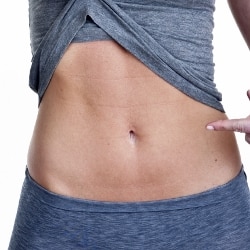 Tummy Tuck