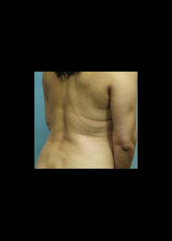 After Image: Patient Case #2549 - front