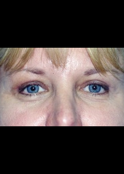 After Image: Patient Case #328 - front