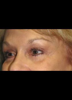 After Image: Patient Case #247 - other