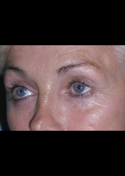 After Image: Patient Case #257 - other