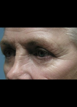 Before Image: Patient Case #257 - other