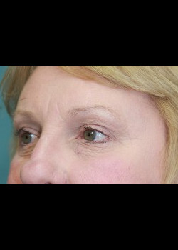 After Image: Patient Case #264 - front