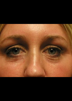 After Image: Patient Case #272 - front