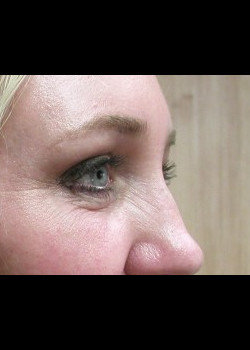 After Image: Patient Case #272 - other