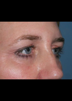 Before Image: Patient Case #272 - other