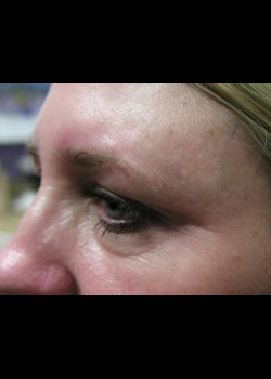 Before Image: Patient Case #272 - other