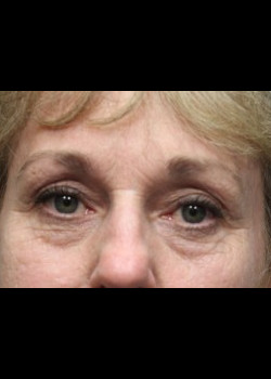 After Image: Patient Case #285 - front
