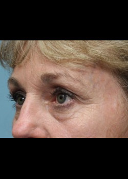 After Image: Patient Case #285 - other