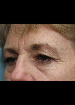 Before Image: Patient Case #285 - other