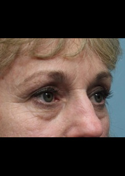 After Image: Patient Case #285 - other