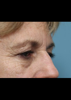 Before Image: Patient Case #285 - other