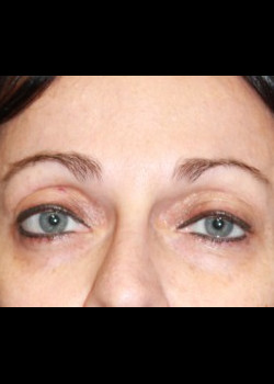 After Image: Patient Case #298 - front