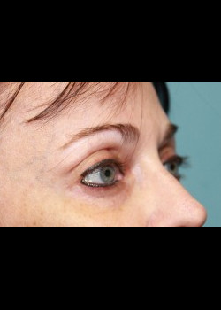 After Image: Patient Case #298 - other
