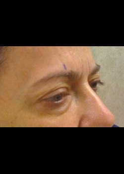 Before Image: Patient Case #298 - other