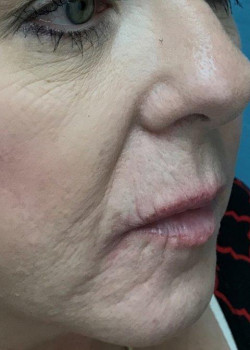 Before Image: Filler #4211 - other